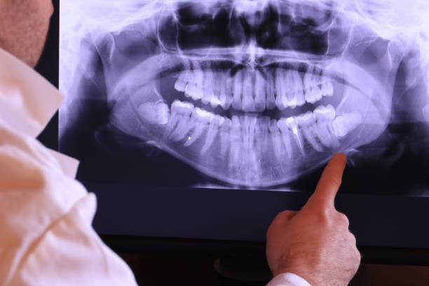 Professional Emergency Dental Service in ID