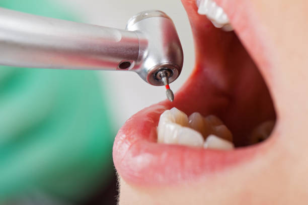Best Emergency Treatment for Jaw Pain or Injury in Ketchum, ID